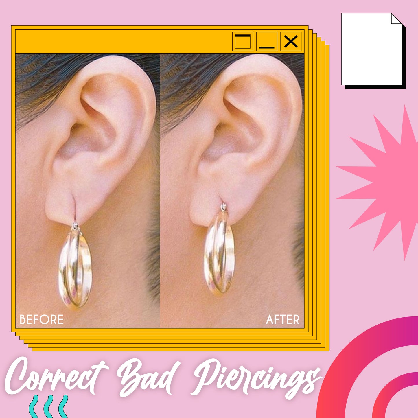 Invisible Ear Lobe Support Patches (60pcs)