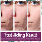 InvisiScar Skin Renewal Cream