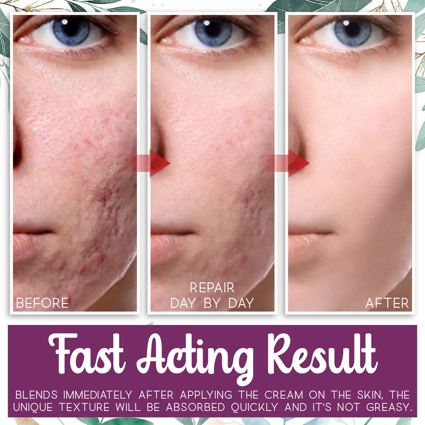 InvisiScar Skin Renewal Cream