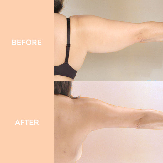 Arm Slimming Essential Oil