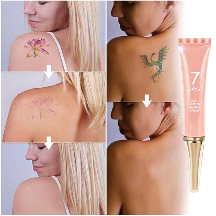 TatBeGone™ Tattoo Removal Cream