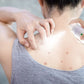 Anti Acne Body Spray