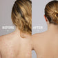 Anti Acne Body Spray