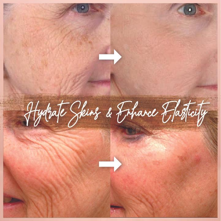Renew™ Anti Wrinkles Serum