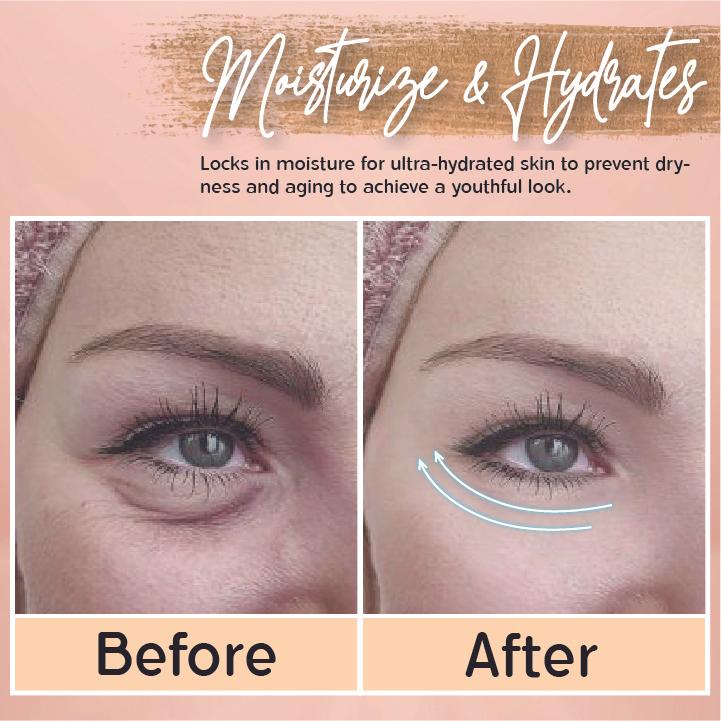 Renew™ Anti Wrinkles Serum