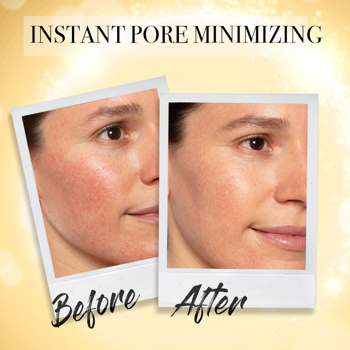 Ultra-Clarifying Acne Out Serum