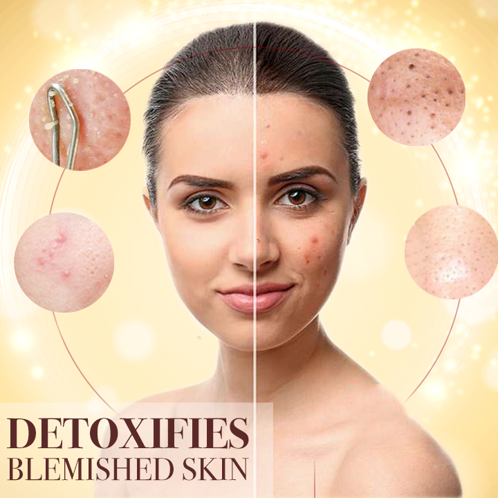 Ultra-Clarifying Acne Out Serum