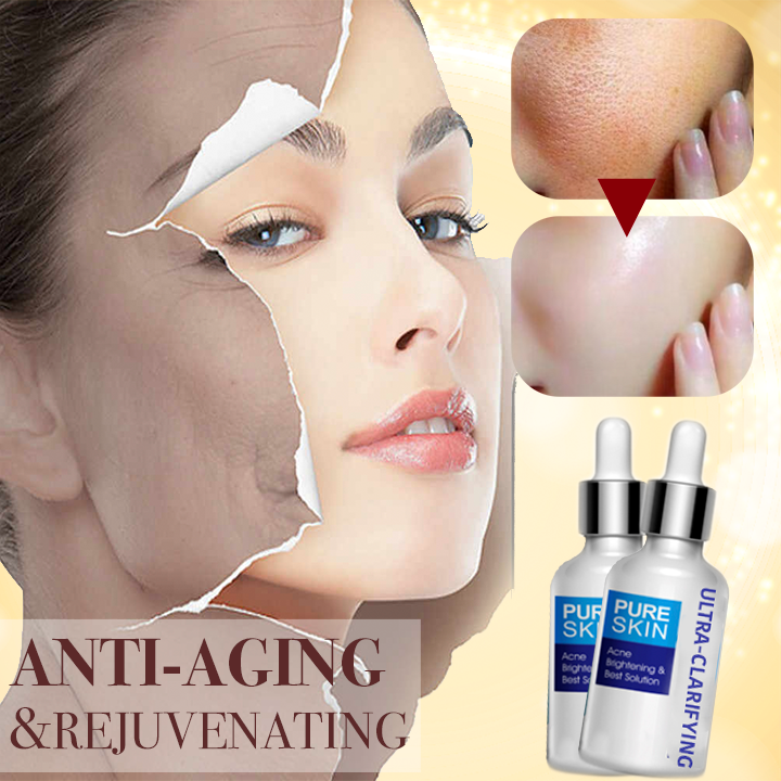 Ultra-Clarifying Acne Out Serum