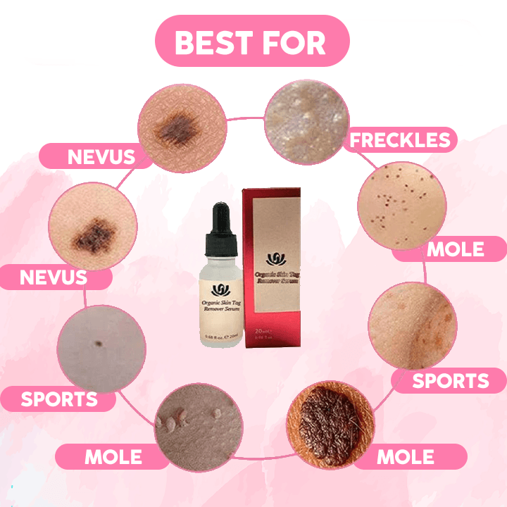 ReFine™ Skin Spot Purifying Essence