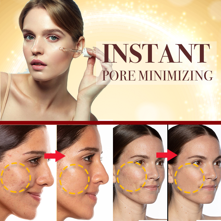 Ultra-Clarifying Acne Out Serum