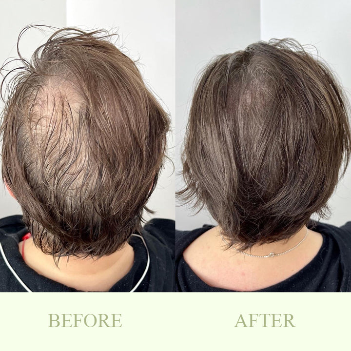 Herbal Hair-Growth Essence