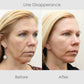 ChaffeeLife™ Wrinkle Reversing Botox Serum