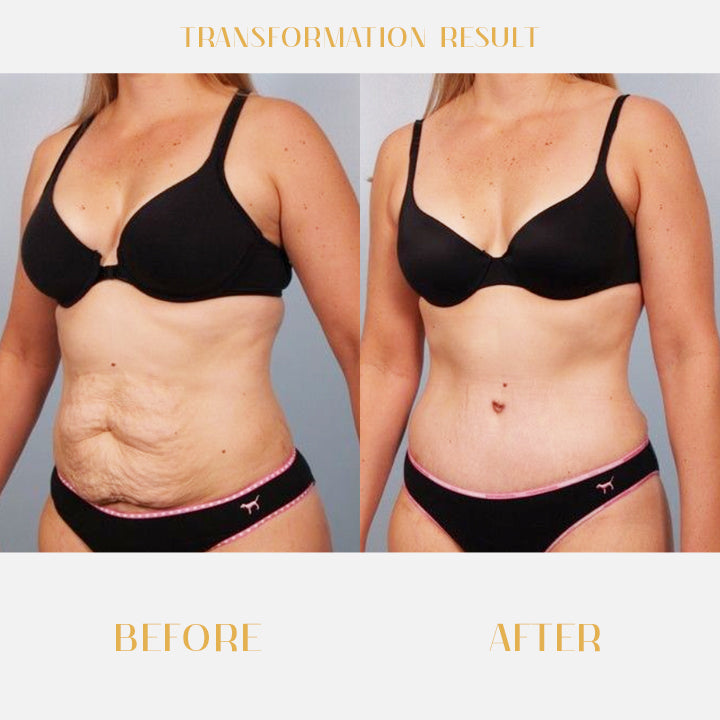 Beautify™ Anti-Cellulite Firming Soap