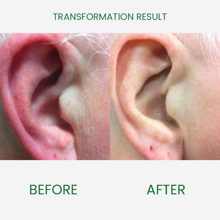 EarRelief™ Ringing Remedy Drop