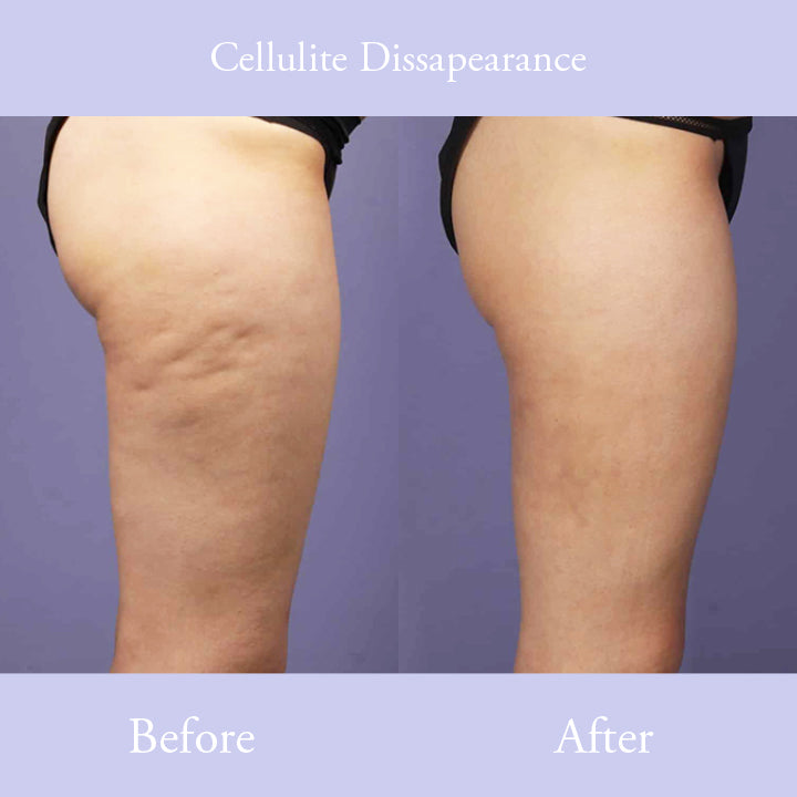 BeOrganic™ AntiCellulite Slimming Soap