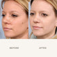 Skin Corrector Clarifying Serum