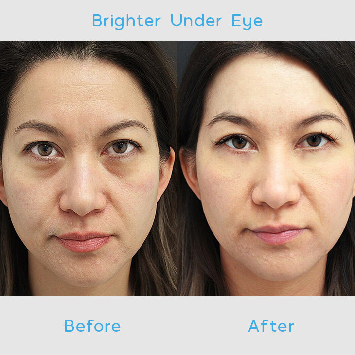 DERMBRIGHT™ Anti-Wrinkle Eye Cream Pro