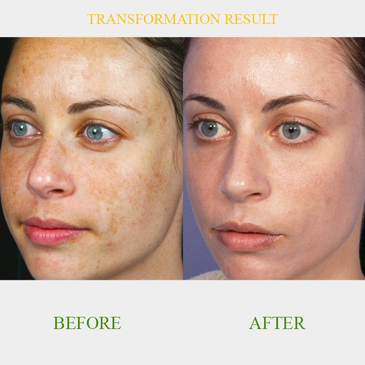 ClearSkin™ Brightening Serum