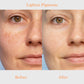 TruSkin™ Blemish Remover Serum