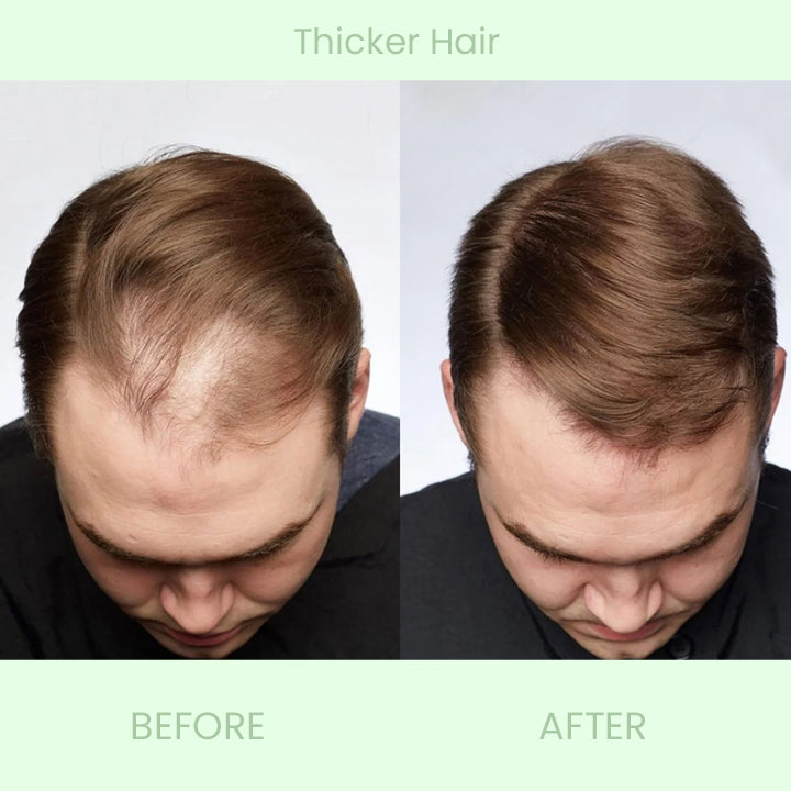 Herbal Hair-Growth Essence