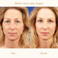 Derm+ Peptid Augencreme Pro