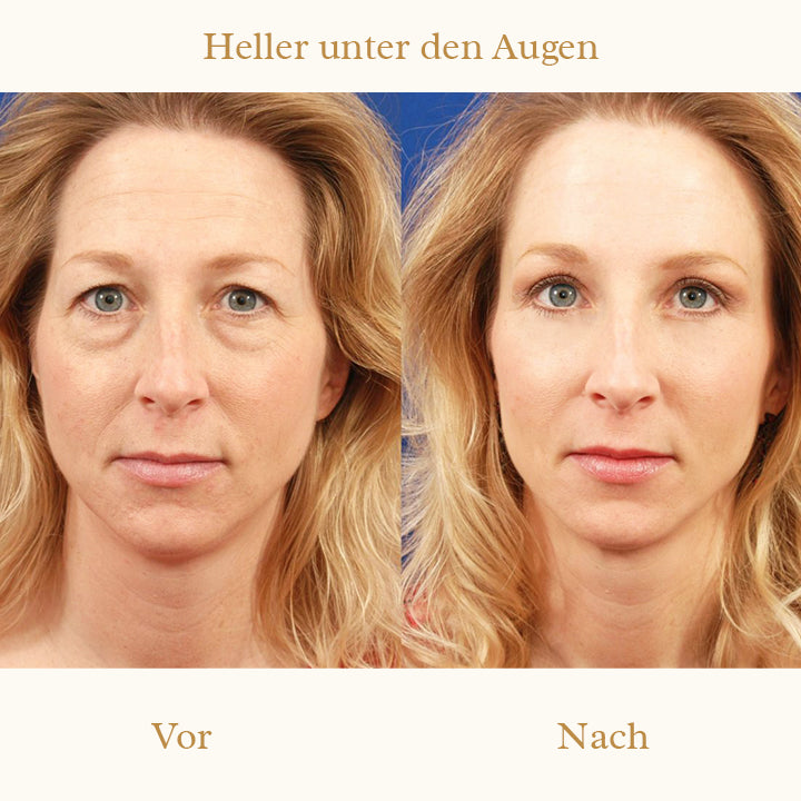 Derm+ Peptid Augencreme Pro