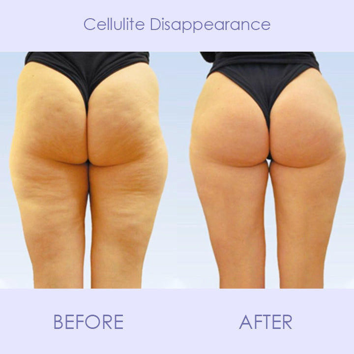 Beautify™ Anti-Cellulite Tightening Patch