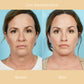 Regenerist™ Anti-Wrinkle and Moisturizing Essence