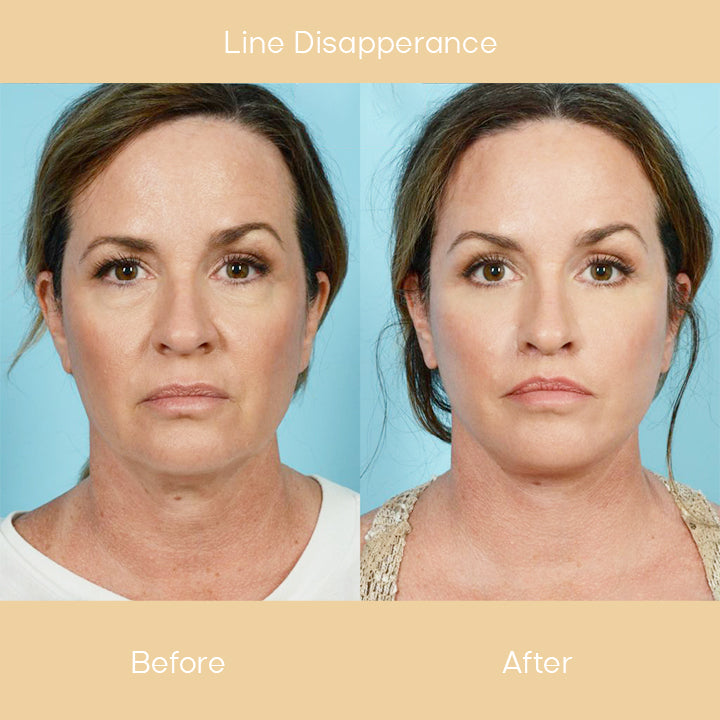 Regenerist™ Anti-Wrinkle and Moisturizing Essence