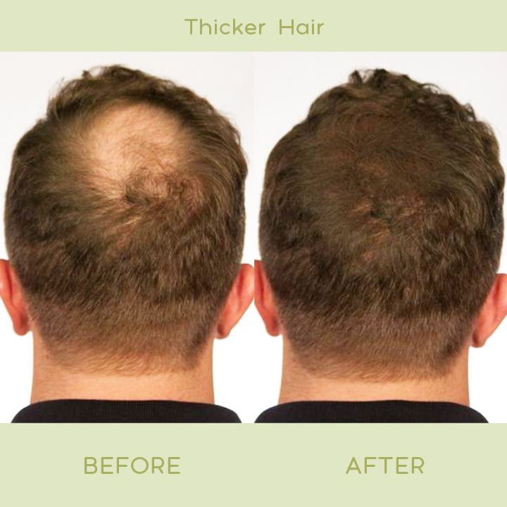 RegrowPlus™ Hair Nourishing Ginger Spray