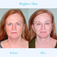 SKINPURE™ Dark Spot Corrector Cream