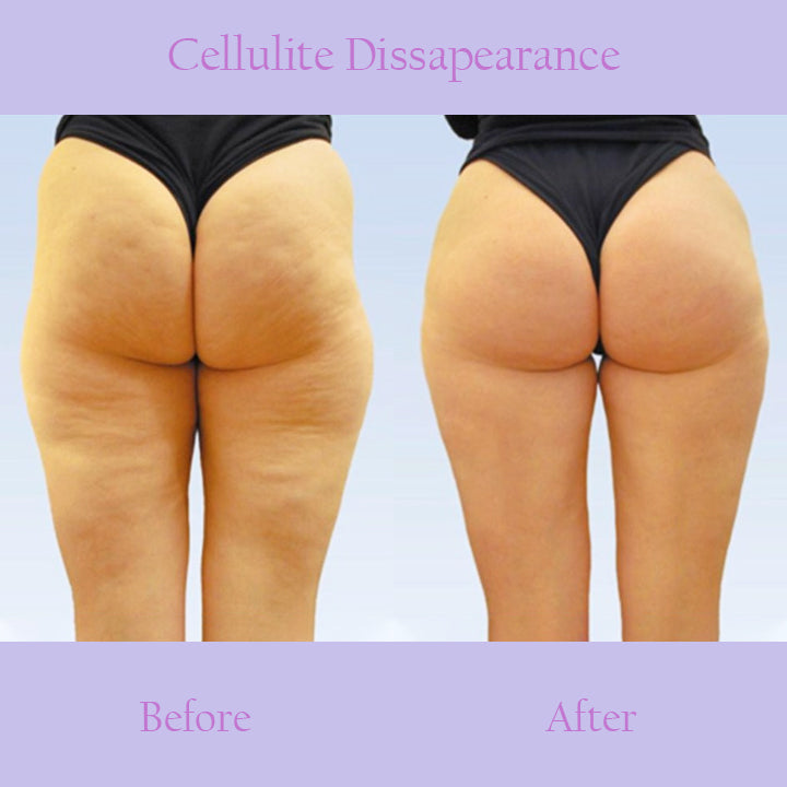 CelluBurn™ Slimming Soap