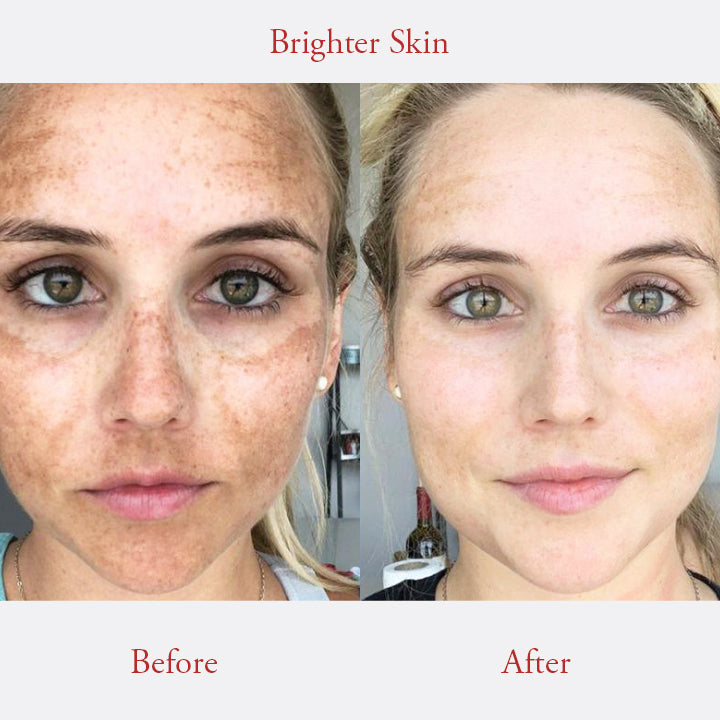 CLARITY™ Freckle Whitening Cream