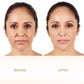 AgeRewind™ 24K Gold Ampoule Serum
