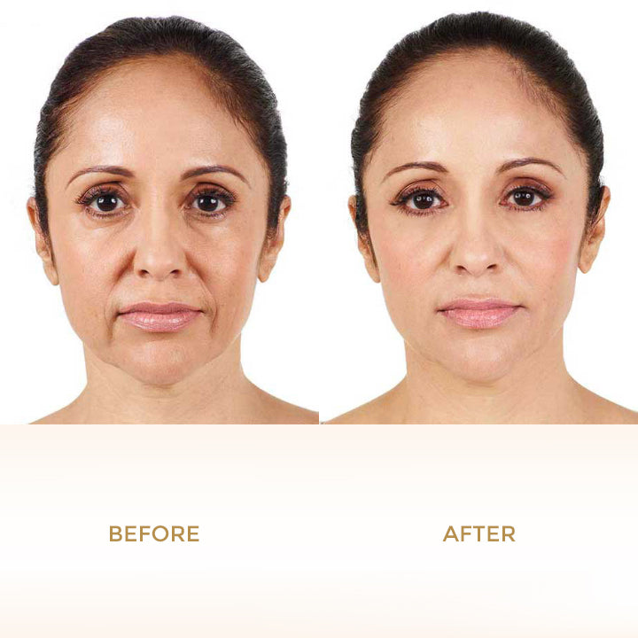 AgeRewind™ 24K Gold Ampoule Serum