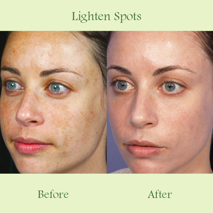 Skinnery™ Pore Cleansing Mask
