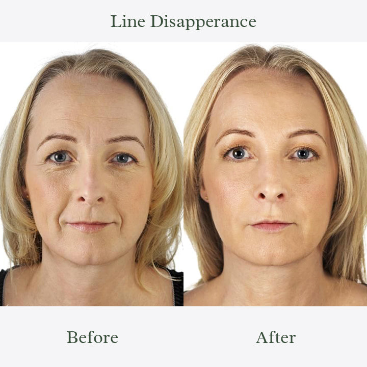 Beautify™ Collagen Firming Mask