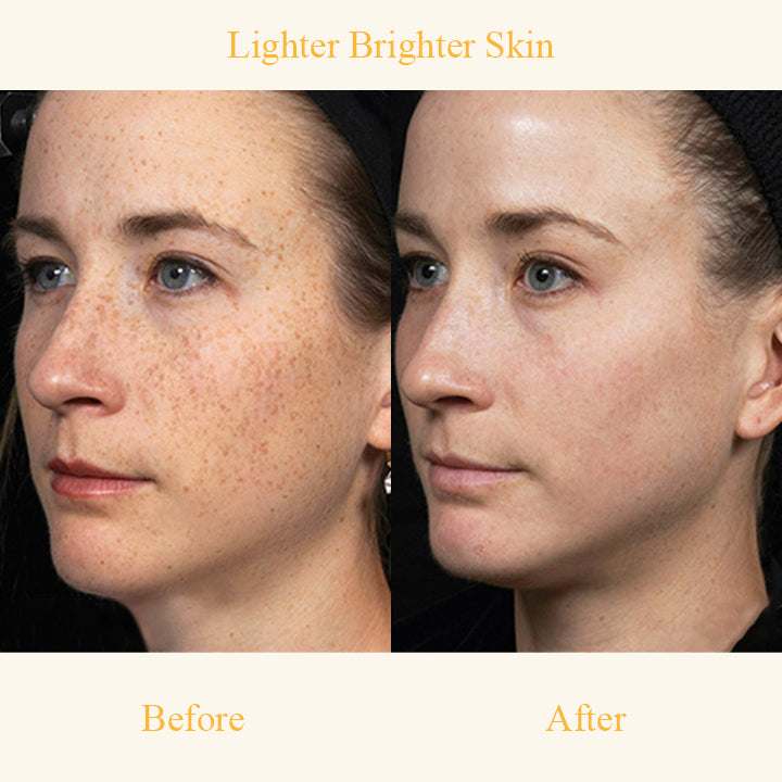 CLEARITY™ Clarifying Serum