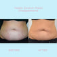ELASTIN™ Anti-Stretch Mark Cream