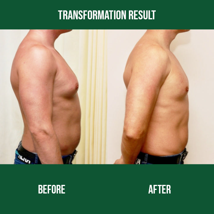 Fit+™ Anti-Gynecomastia Ointment