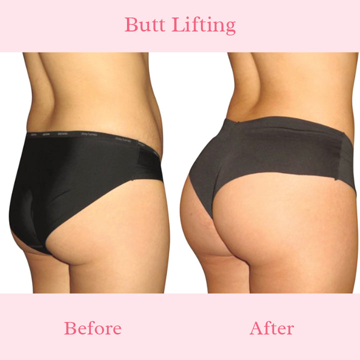 PeachyBum™ Hip Massage Cream