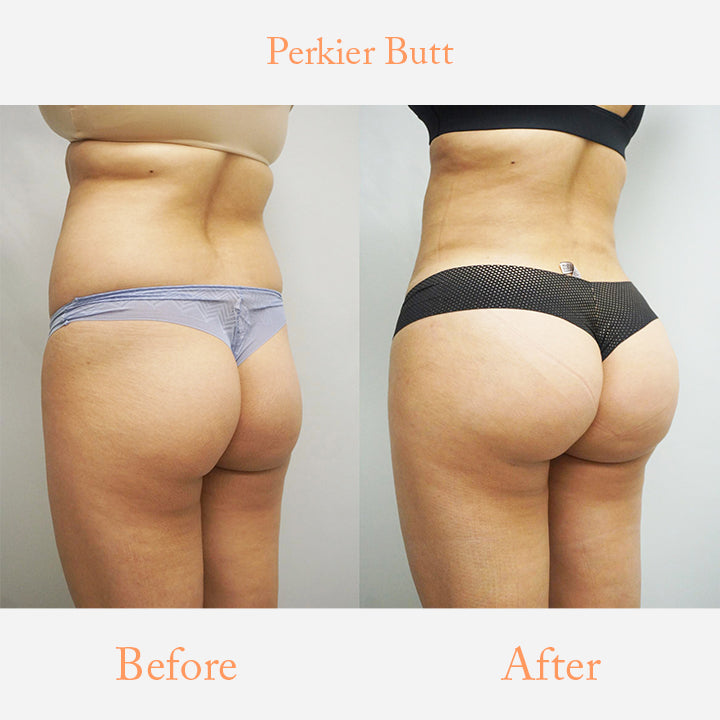 PlumpOrigin Buttlock Enhancement Collagen Soap