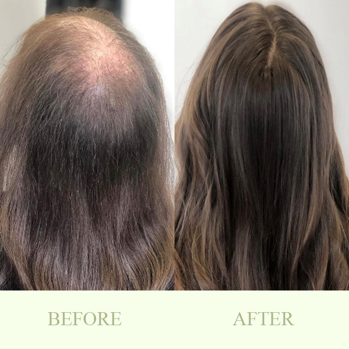 Herbal Hair-Growth Essence