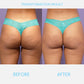 FirmSkin™ Tightening Essence Spray