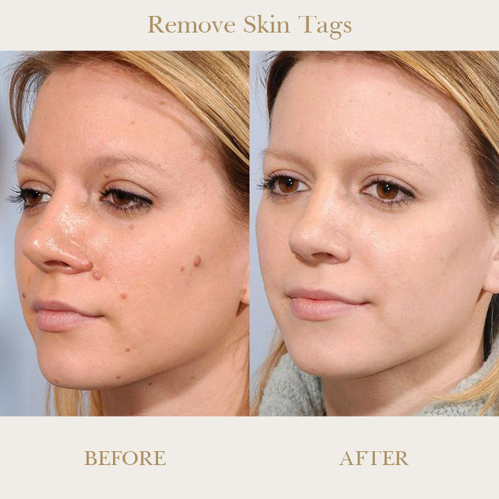 SkinRenew™ Spot Refining Serum