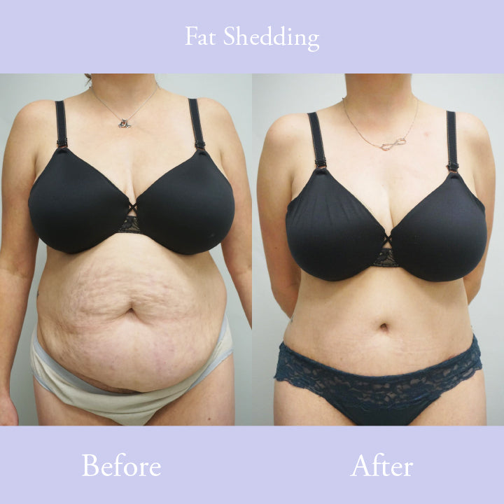 BeOrganic™ AntiCellulite Slimming Soap