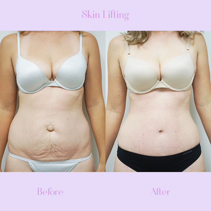 Fab&Firm™ Anti-Cellulite Slimming Soap