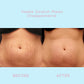 ELASTIN™ Anti-Stretch Mark Cream