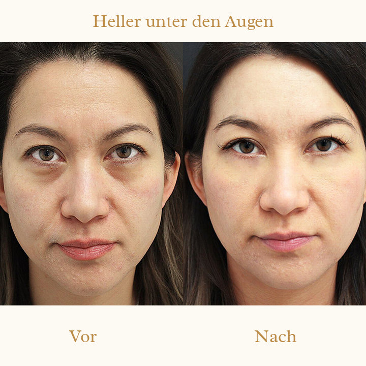 Derm+ Peptid Augencreme Pro