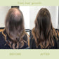 RegrowPlus™ Hair Nourishing Ginger Spray